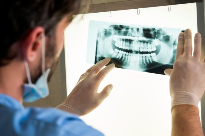 dientes conejo protrusión