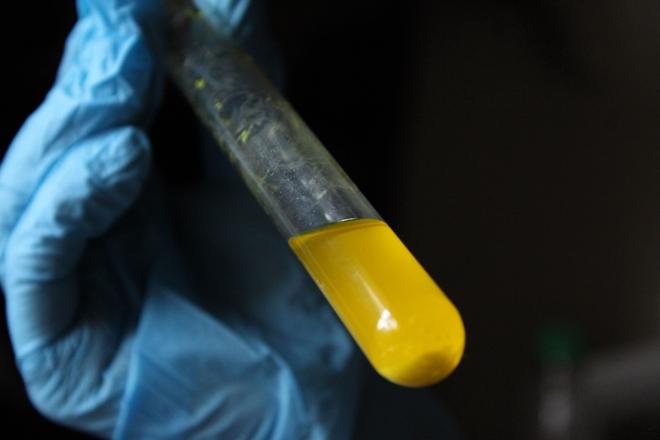 Infección orina mayores con pañal