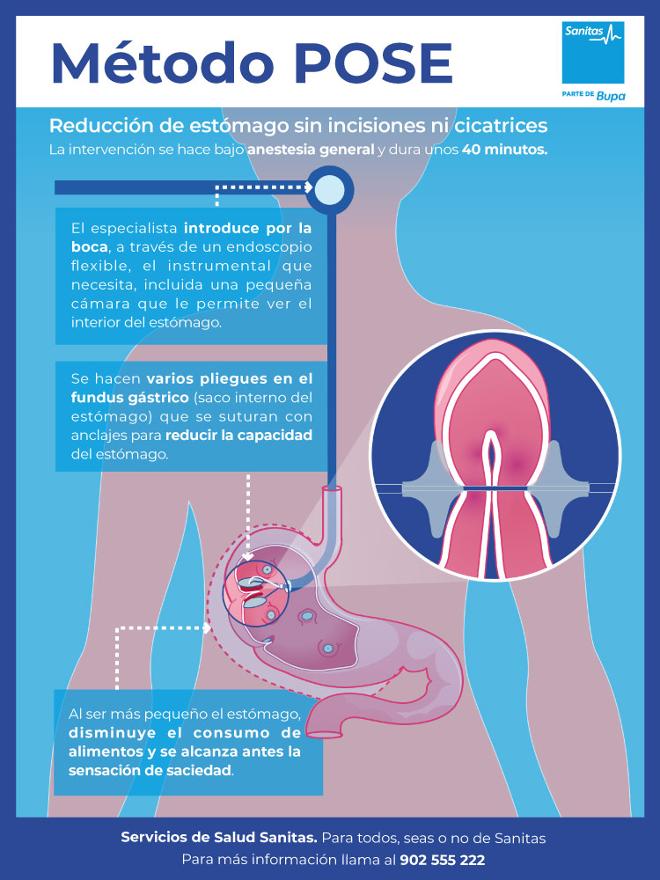 método POSE