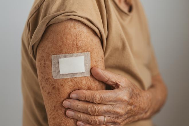 Parches de rivastigmina