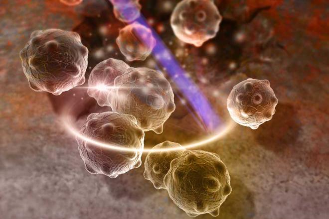 tumores neuroendocrinos