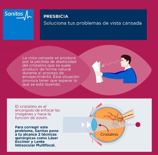 prebicia vista cansada