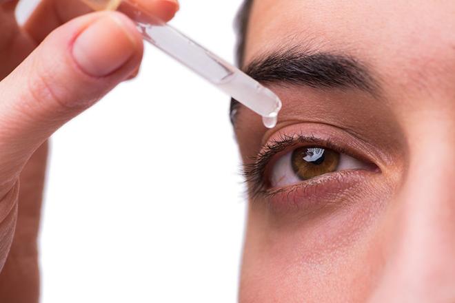 conjuntivitis alérgica