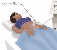 ecografia ginecologica
