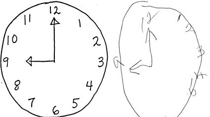 Tu forma de dibujar un reloj permite saber si sufrirás Alzheimer o