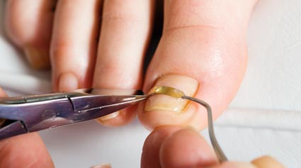 Fluconazol Mas Barato