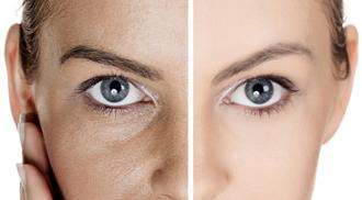 Peeling facial