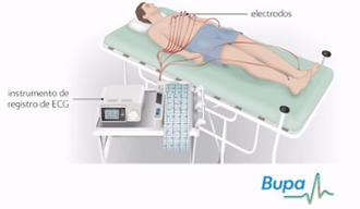 Foto: Representación de la prueba de electrocardiograma