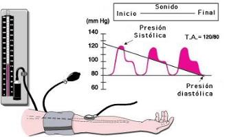 Imagen cardio hipertension