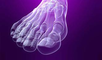 metatarsalgia lesiones