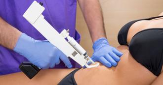 mesoterapia estética