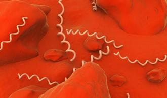 sífilis transmisión sexual