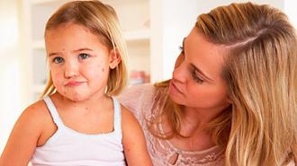 alergias infantiles
