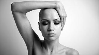 alopecia en mujeres