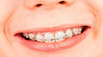 aparatología fija y removible