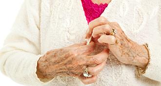 artritis enfermedad inflamatoria