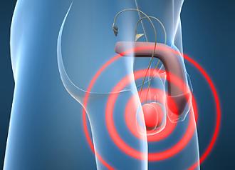 belanitis síntomas y tratamiento