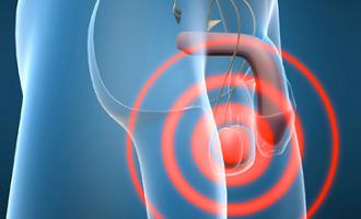cáncer testicular preservar la fertilidad