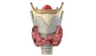 cáncer de tiroides