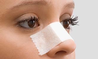 técnicas cirugía plástica de nariz