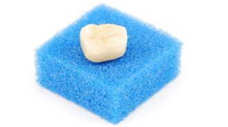 corona dental