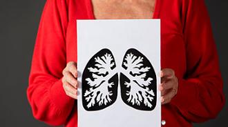 derrame pleural
