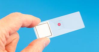 Displasia cervical y embarazo