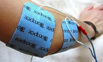 electroestimulación transcutánea