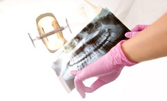 enfermedades dentales por mala alimentación