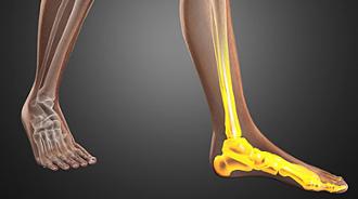 escala downton riesgo caídas