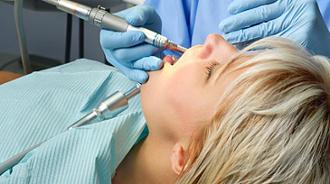 frenectomía defectos frenillos