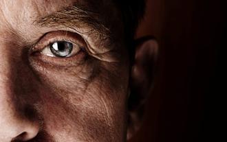 glaucoma de ángulo abierto