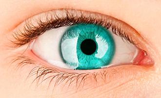 glaucoma secundario