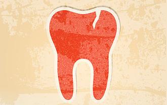 golpe en los dientes