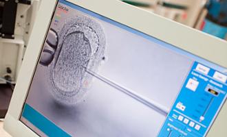 inyección intracitoplasmática espermatozoides