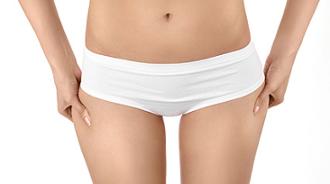 laserlipólisis o liposucción por láser