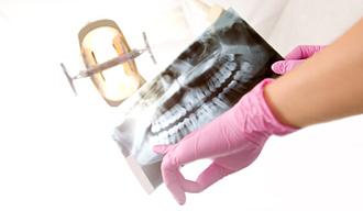 ortodoncia mordida cruzada