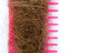 pérdida o adelgazamiento del cabello