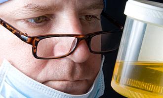 infecciones de orina: prostatitis