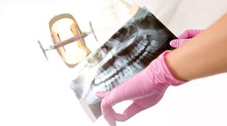 quiste dental