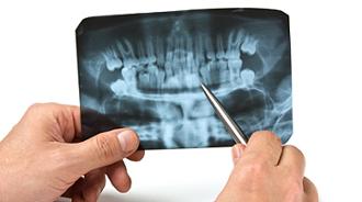 radiografía oclusal