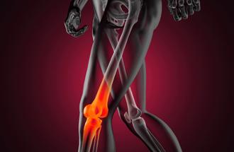 rotura del ligamento cruzado anterior