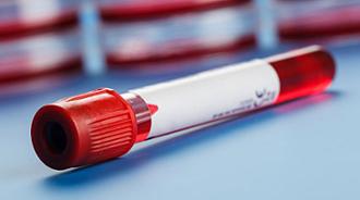 test genético de cáncer de mama