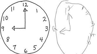test del reloj