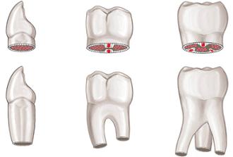 tipos de dientes