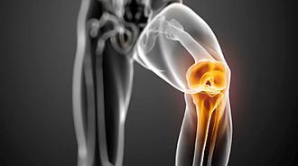 trasplante de menisco