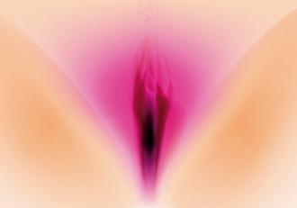 ¿Qué es la vulvovaginitis?