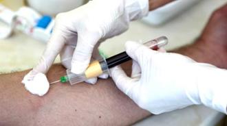 prediabetes enfermedades cardiovasculares