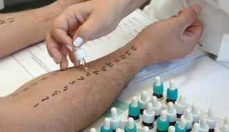 Diagnóstico alergia
