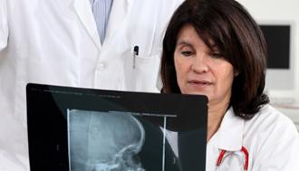 tumor cerebral